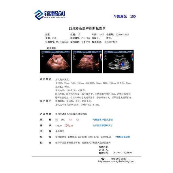 医用超声胶片